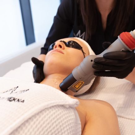 kobieta w trakcie zabiegu laseroterapii na twarz zmarszczki poprzeczne na czole